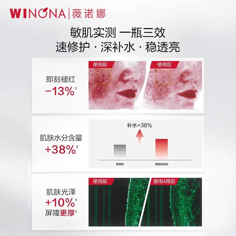 中国薇诺娜WINONA舒敏保湿特护精华水120ml
